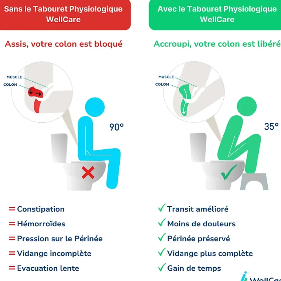 WC à poser sans bride sortie horizontale JACOB DELAFON Struktura avec abattant + Tabouret physiologique blanc